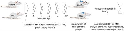 Epilepsy-related functional brain network alterations are already present at an early age in the GAERS rat model of genetic absence epilepsy